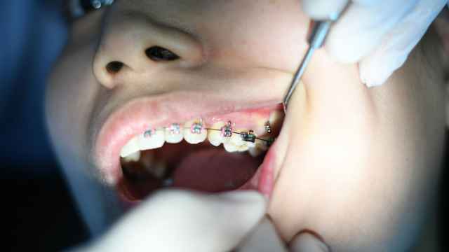 Dental Floss